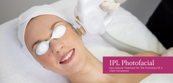 What's IPL  ( Intense Pulse Light) treatment? How does it improve blood vessels, rosacea and age spots?