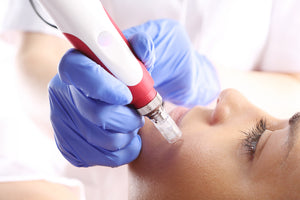 Look and Feel Rejuvenated with Microneedling