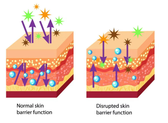 Why ceramides are important for skin barrier? Here is why