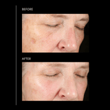 PCA Skin Pigment Gel Pro 1oz