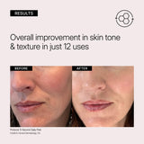 Neova 5-SECOND DAILY PEEL