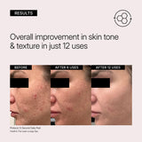 Neova 5-SECOND DAILY PEEL