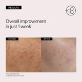 Neova Cell Renewal Serum Direct Response Daily Serum with Alpha-Beta-Retinol 1oz
