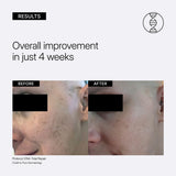 Neova Perfect Repair Kit (DNA Total Repair Serum and Silc Sheer SPF 40 Sunscreen)