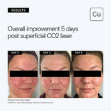 Neova CU3 TISSUE REPAIR Recovery Cream with Copper Peptide Complex® 2 oz