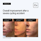 Neova CU3 TISSUE REPAIR Recovery Cream with Copper Peptide Complex® 2 oz